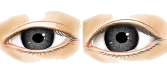 Real Gold Center Eye Ink PNG