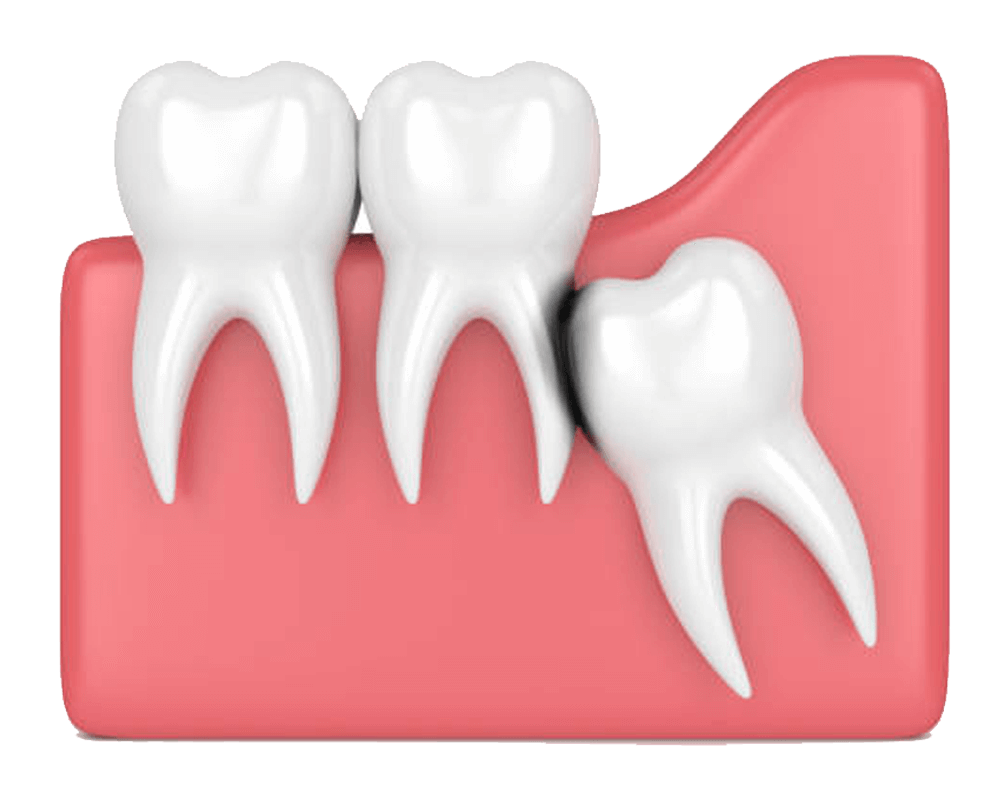 Incisors Mandibles Dents Scalp Skull PNG